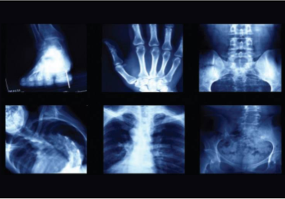 Digital X-Ray